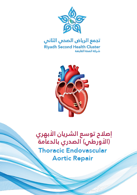 HEM1.24.0001647 thoracic endovascular aortic repair.pdf